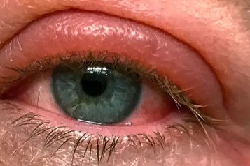 اورژانس های غیر مرتبط با ضربه