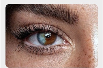 هتروکرومیا یا چشم هایی با رنگ های متفاوت