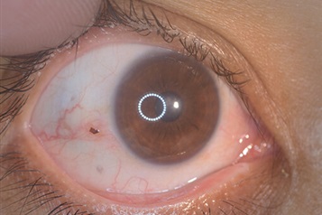 اورژانس های مرتبط با ضربه