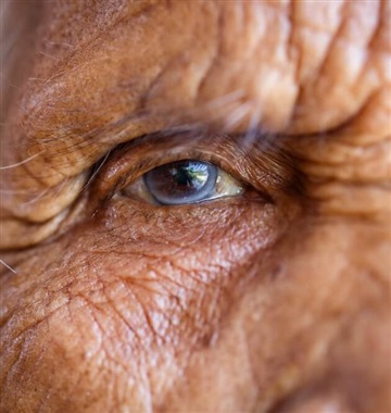 آب مروارید سالمندان