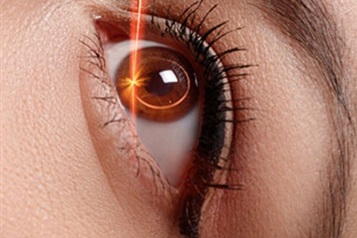 درمان لیزری کاهنده فشار داخل چشم