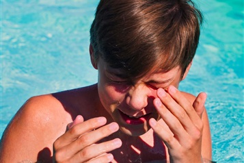 قرمزی چشم بعد از شنا در استخر