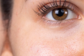 دانستنیهایی درباره جراحی زیبایی ناحیه چشم