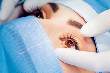 Femto-LASIK Surgery