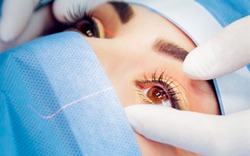 Femto-LASIK Surgery