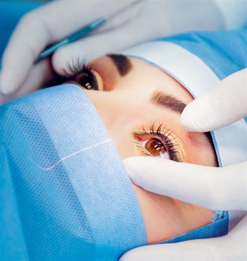 Femto-LASIK Surgery