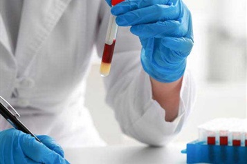 آمادگی های لازم قبل از آزمایش