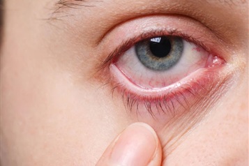 تاثیر وارونگی دما بر چشم ها 