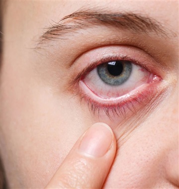 تاثیر وارونگی دما بر چشم ها 