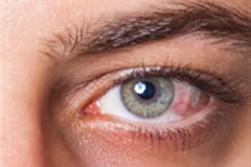 تاثیر داروهای خاص و بی خوابی روی چشم