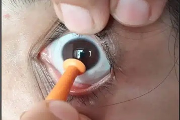 معرفی روش PROSE