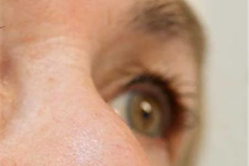 خانه داری و آشپزی بعد از عمل آب مروارید 