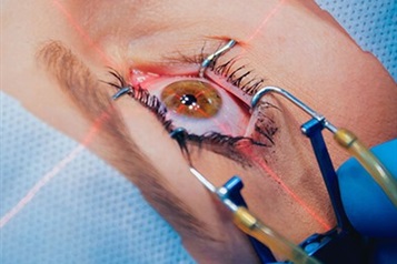 تفاوت عمل فمتولیزیک و فمتو اسمایل