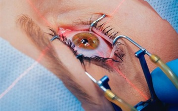 تفاوت عمل فمتولیزیک و فمتو اسمایل