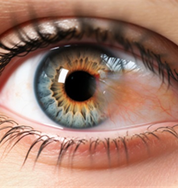 Pterygium Surgery