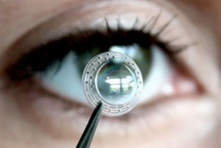 رد پیوند قرنیه، دلایل و درمان آن