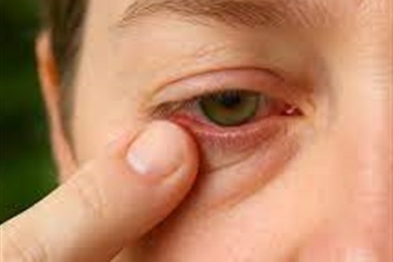 گرد و غبار با چشم ما چه می کند؟