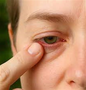 گرد و غبار با چشم ما چه می کند؟