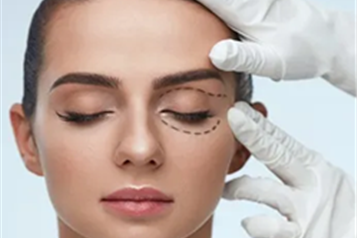 لیفت چشم چیست و چگونه انجام می شود؟