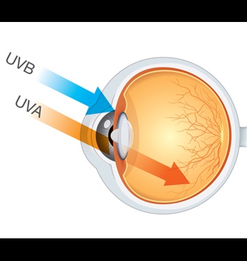بیماری های چشمی ایجاد شده توسط اشعه uv