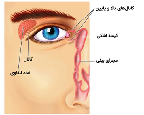 عمل انسداد مجرای اشکی بزرگسالان