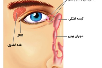عمل انسداد مجرای اشکی بزرگسالان