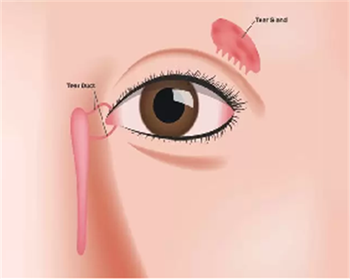 تومور غدد اشکی