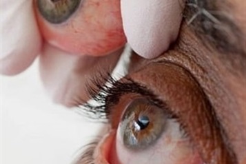 هر آنچه باید درباره تخلیه چشم بدانید