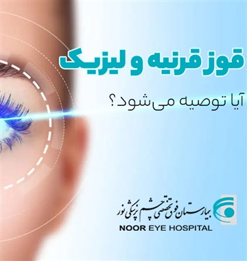 قوز قرنیه و لیزیک: آیا جراحی لیزیک برای بیماران قوزقرنیه مناسب است؟