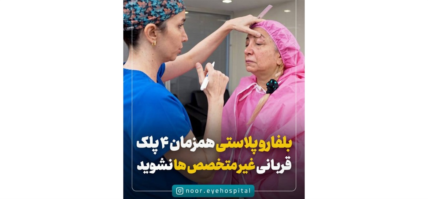 بلفاروپلاستی بدون جراحی