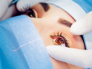 Femto Lasik Surgery